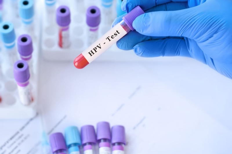 Importanta testului HPV in prevenirea cancerului de col uterin: ghidul complet